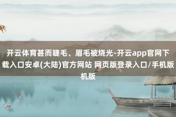 开云体育甚而睫毛、眉毛被烧光-开云app官网下载入口安卓(大陆)官方网站 网页版登录入口/手机版